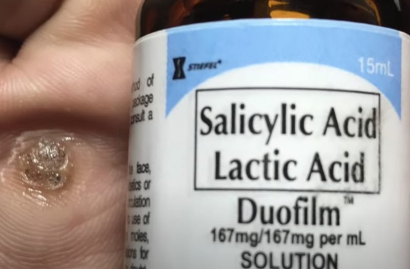 Duofilm Salicylic Acid For Warts